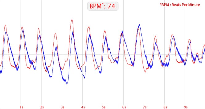 Waveforms of application circuit of low noise Op-amp TC75S67TU for pulse sensor.